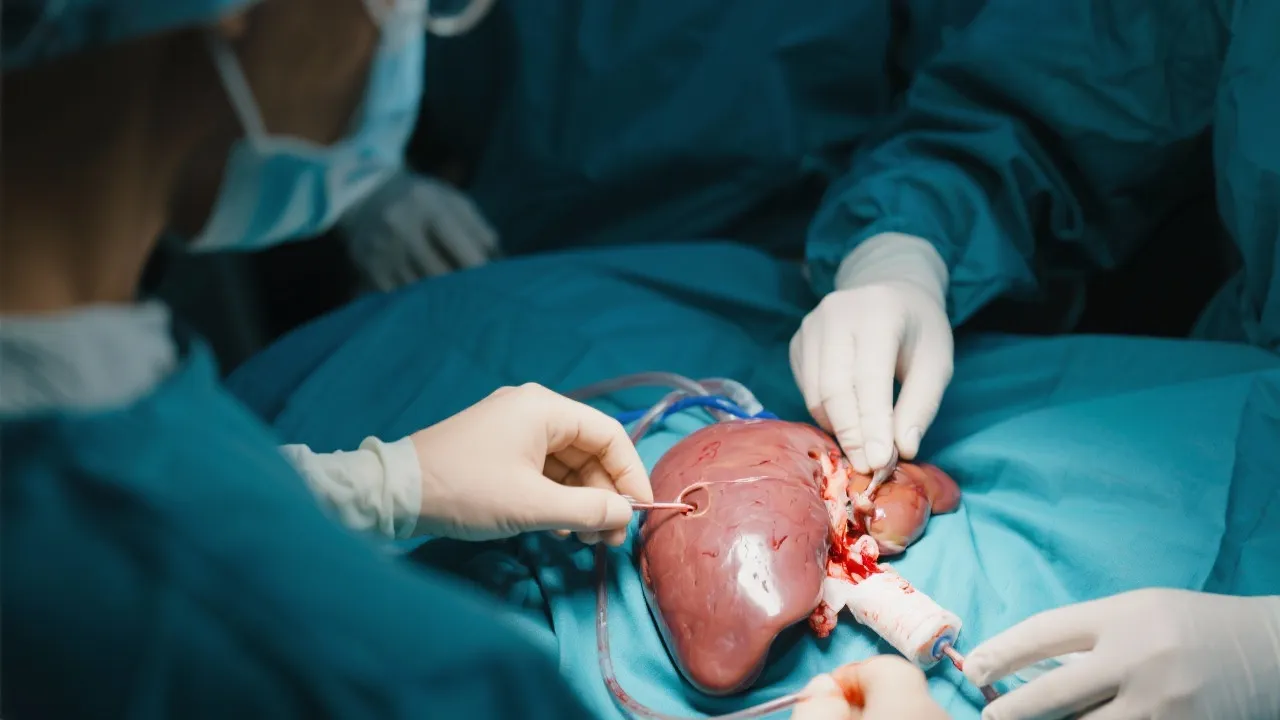 Understanding Hepatitis E and Liver Transplants